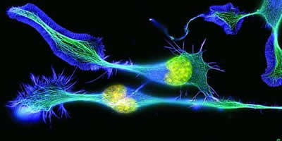 Neuroblastoma de ratón en diferenciación. Se aprecia el citoesqueleto con al actina (azul) y los microtúbulos (verde). Las dos células iniciales redondeadas (imagen 39) se han alargado con sus respectivos núcleos (amarillo) para formar las neuritas incipientes, que darán lugar a los futuros axones y dendritas.